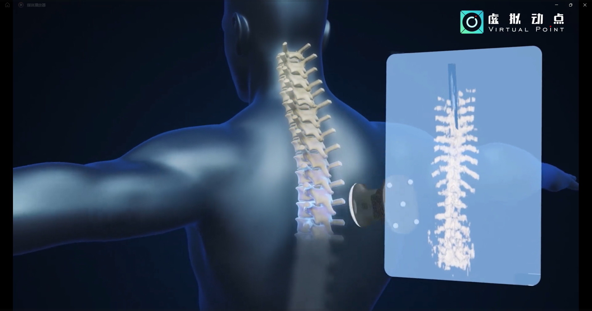 平博·虚拟动点OptiTrack开创3D超声成像在脊柱诊断中的应用